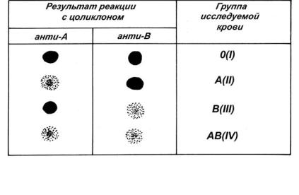 Группа крови цоликлонами алгоритм. Результат реакции с цоликлонами. Определение группы крови цоликлонами таблица. Цоликлоны для определения группы крови таблица. Таблица реакции цоликлонов.