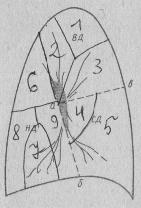 2. Легкие