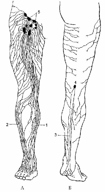 Лимфоузлы на ногах где. Поверхностные лимфатические узлы нижней конечности. Лимфоузлы коленного сустава схема. Поверхностные лимфатические сосуды нижней конечности.