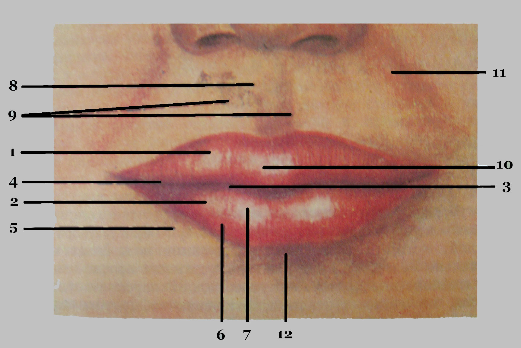 Верхний край губы. Красная каймв нижнейгубы. Красная кайма верхней губы. Красная кайма губ анатомия.