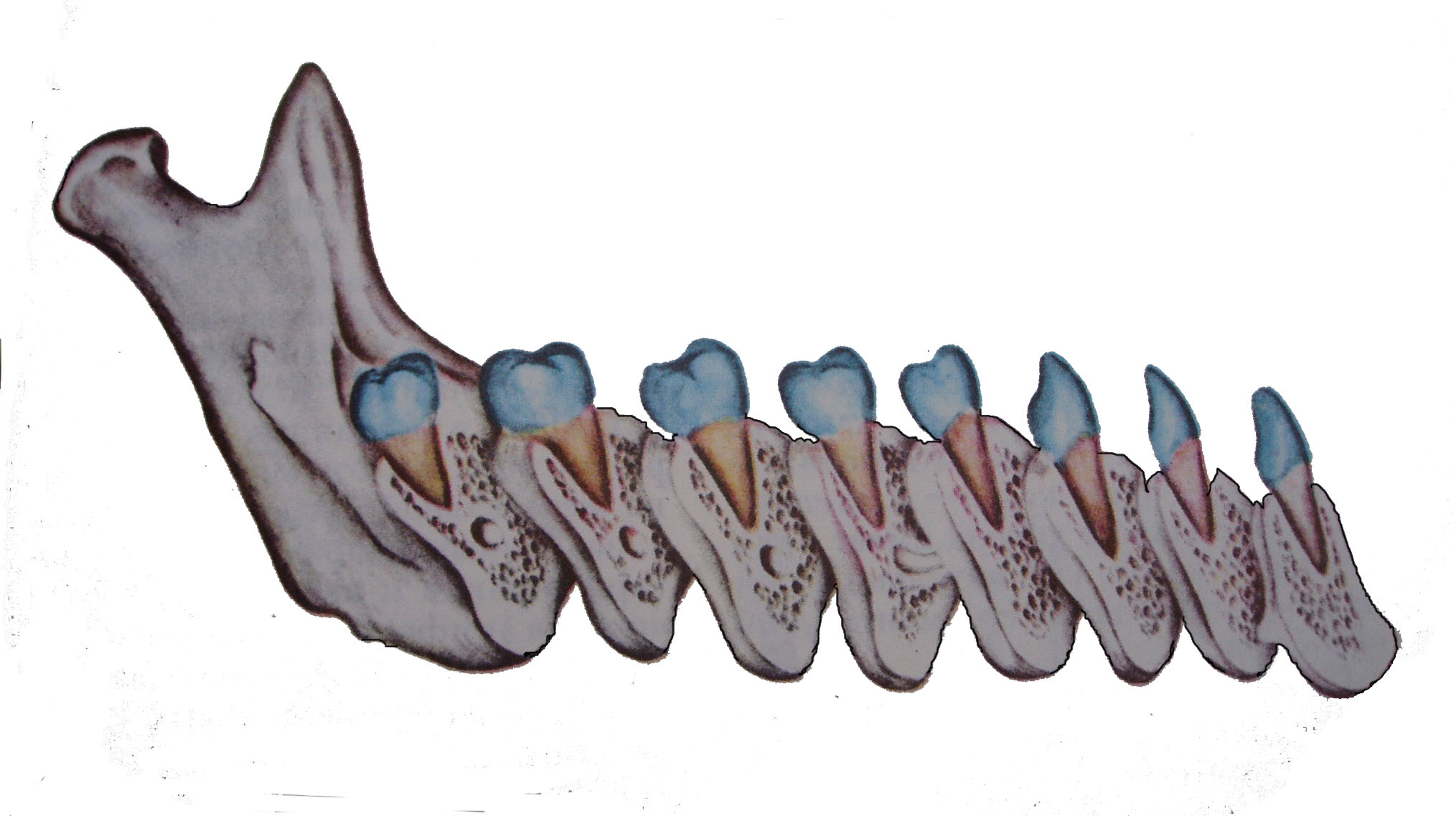 Зуб без кости. Альвеолярный отросток нижней челюсти на кт. Кортикальная пластинка альвеолярного отростка. Альвеолярная кость челюсти. Альвеолярный отросток зуба.