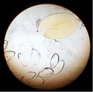 Онкосферы тениид. Яйцо онкосфера Финна-цистеркоид. Яйца с шаровидной онкосферой. Яйца Тениида Солюм. Яйцо с онкосферой