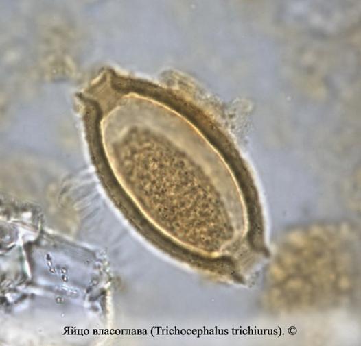 távolítsa el a pinwormokat természetesen genitális herpesz papilloma vírus