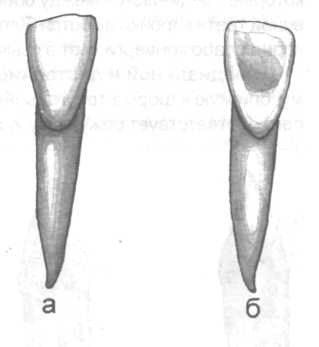 Зуб боковой резец. Латеральныйрезец нижней челюстиъ. Латеральный резец нижней челюсти. Латеральный резец нижней челюсти левый. Латеральный резец верхней челюсти.