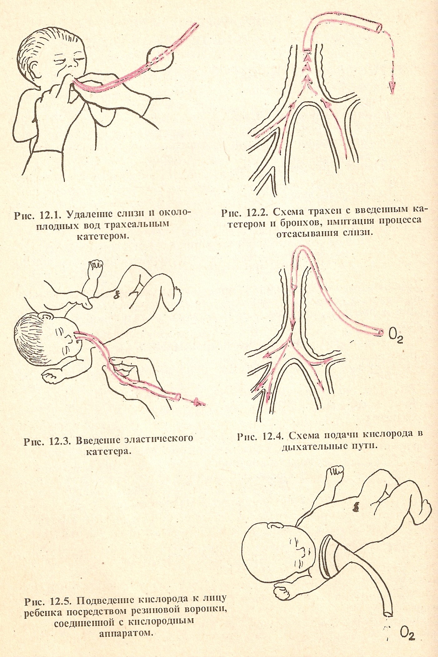 Рождение ребенка схема