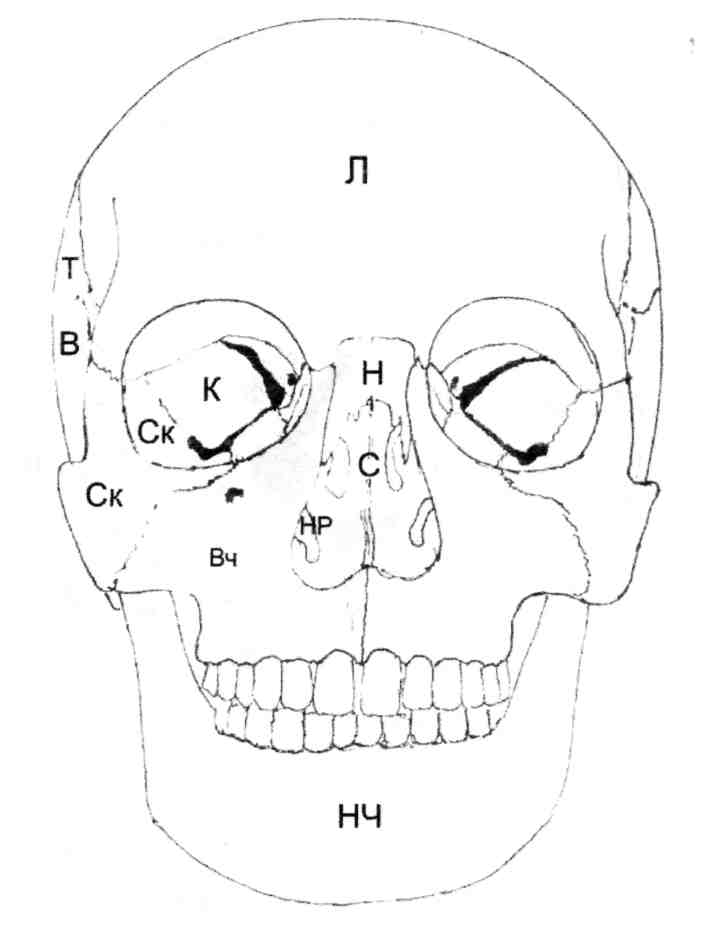 Глазные впадины на черепе мужской и женский. Формы глазных впадин у черепов. Глазная впадина 6 букв