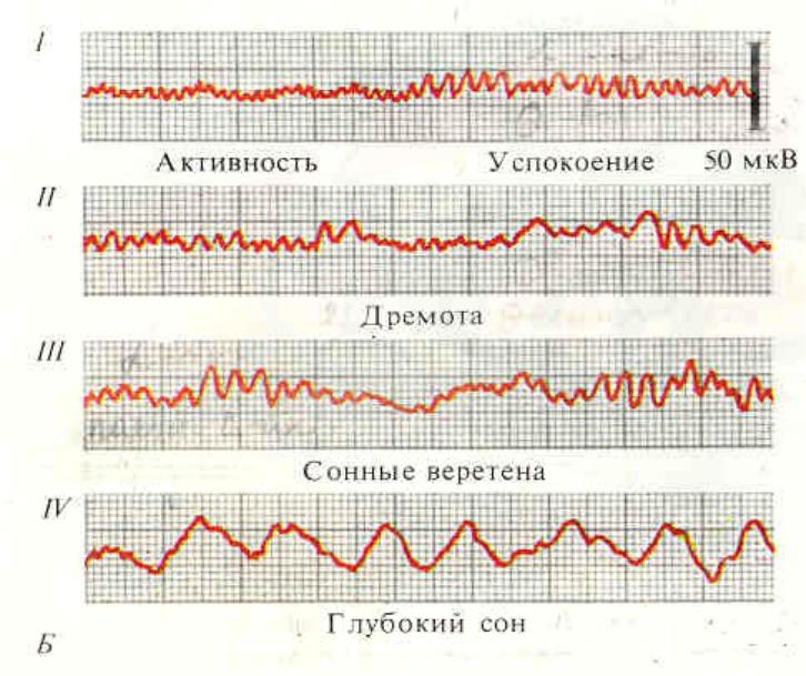 Схема стадий сна по данным ээг
