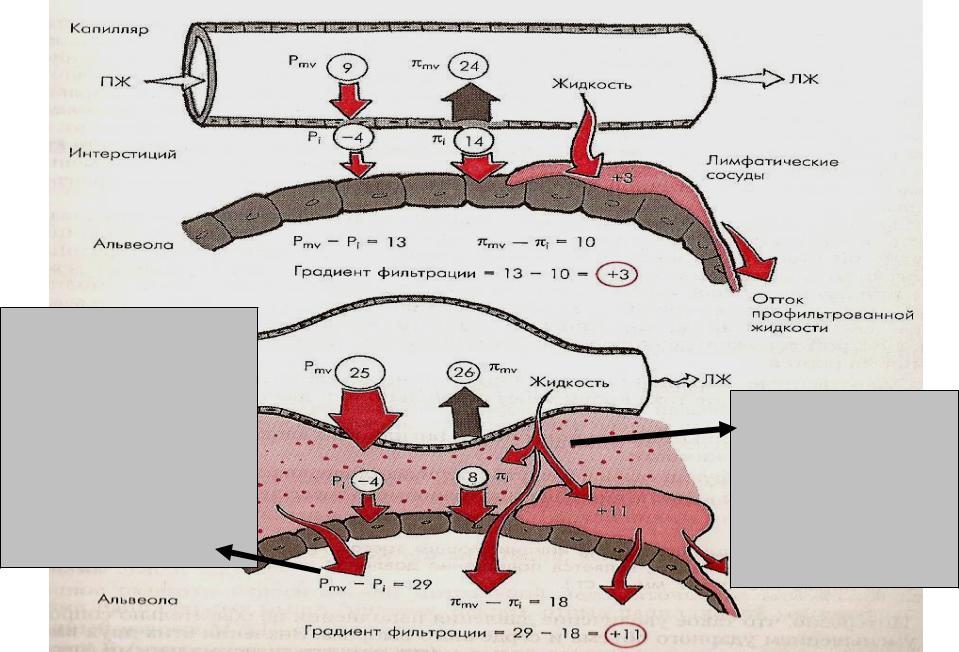 Выход жидкости. Интерстициальное пространство легких. Интерстициальная жидкость. Сосуды и интерстициальная ткань.