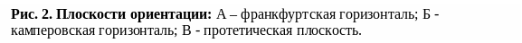 Frame1