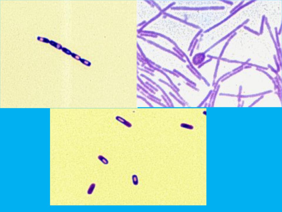 Клостридиум диффициле. Bacillus anthracis Сибирская язва. Bacillus anthracis окраска по Ребигеру. Окраска по Ребигеру Сибирская язва. Сибирская язва под микроскопом по Ребигеру.
