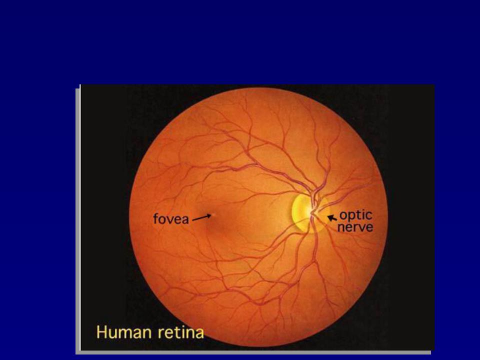 Офтальмоскопия что это. Глазное дно с широким зрачком. Прямая и Обратная офтальмоскопия. Мидриатики для исследования глазного дна. Офтальмоскопия.