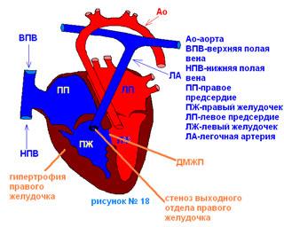 Правое предсердие аорта левый желудочек легкие левое. Полые вены впадают в правый желудочек. Верхняя полая Вена правое предсердие. Правый желудочек и легочная артерия. Нижняя полая Вена впадает в левое предсердие.