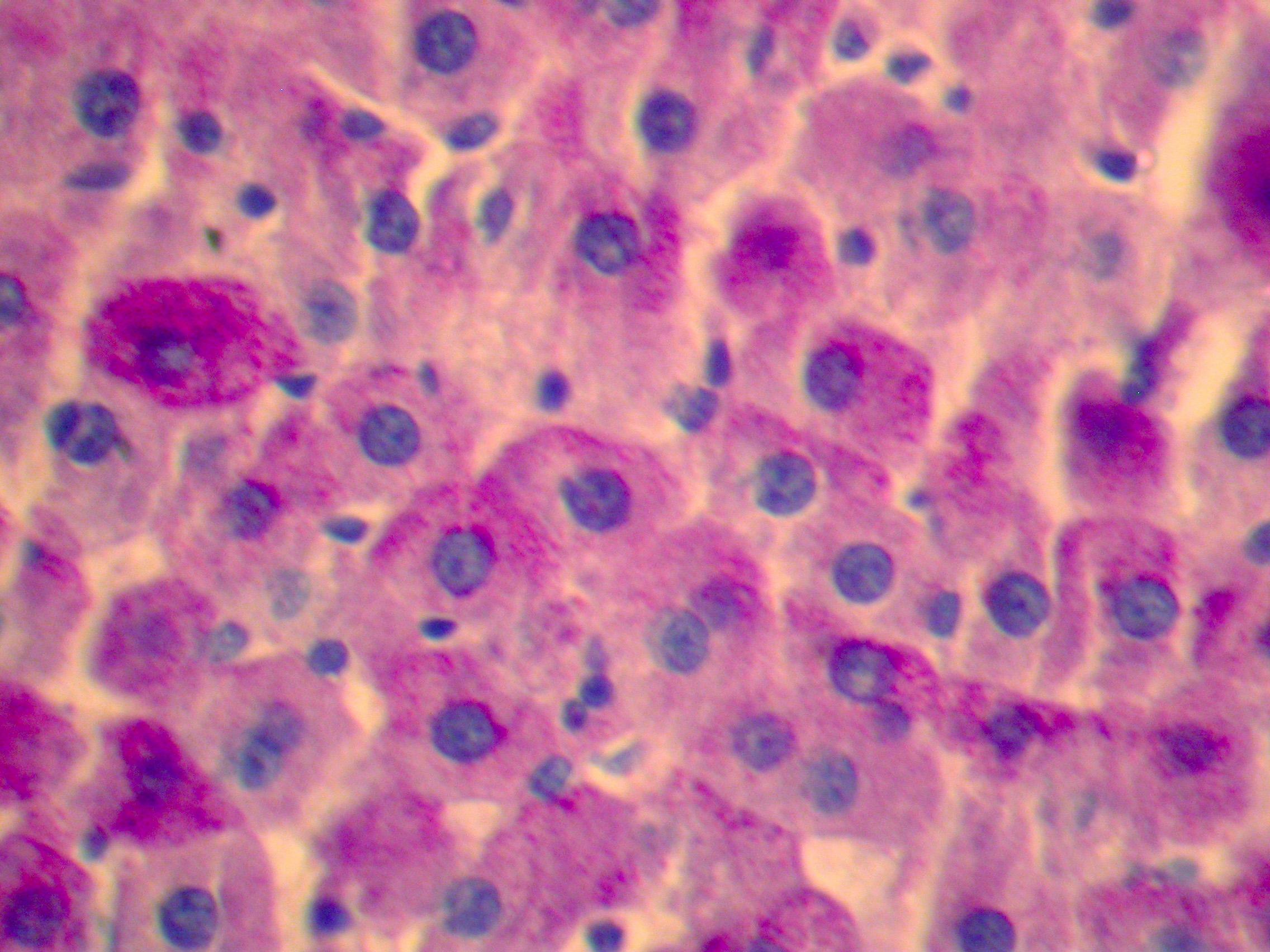 Иммунные клетки печени. Включения гликогена в печени аксолотля. Включения гликогена в клетках печени. Включения гликогена в клетках печени аксолотля. Включения гликогена в клетках печени аксолотля под микроскопом.