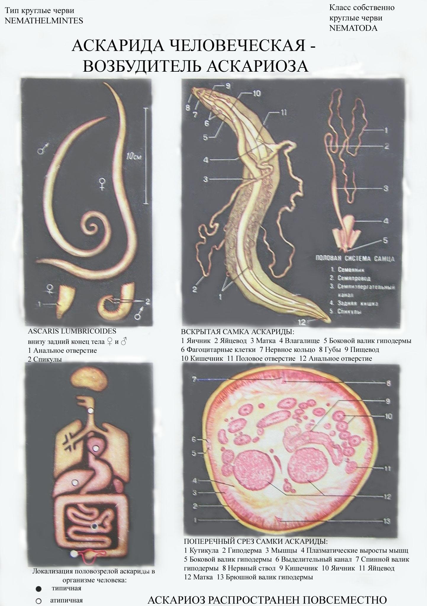 Аскарида тип. Тип круглые черви аскарида человеческая. Аскариды локализуется. Оскариды человеческая. Круглый червь человеческая аскарида.