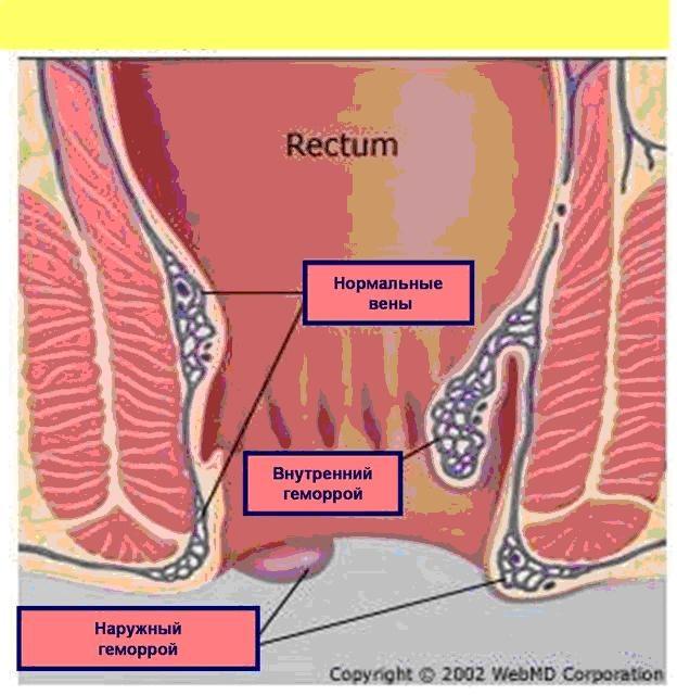 Расширение сфинктера. Кавернозные вены прямой кишки. Геморроидальные узлы анатомия.