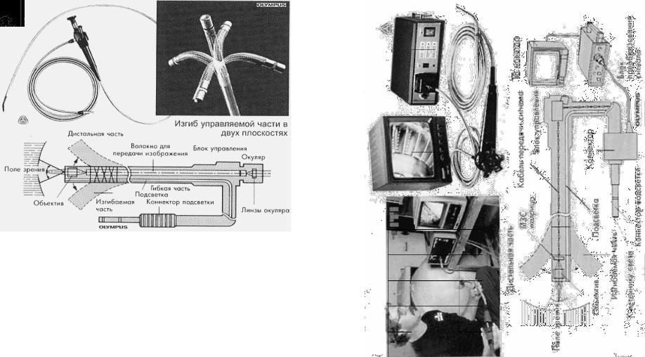Части эндоскопа. Схема линзового эндоскопа. Гибкий эндоскоп схема. Жестком линзовом эндоскопе схема. Строение гибкого эндоскопа.