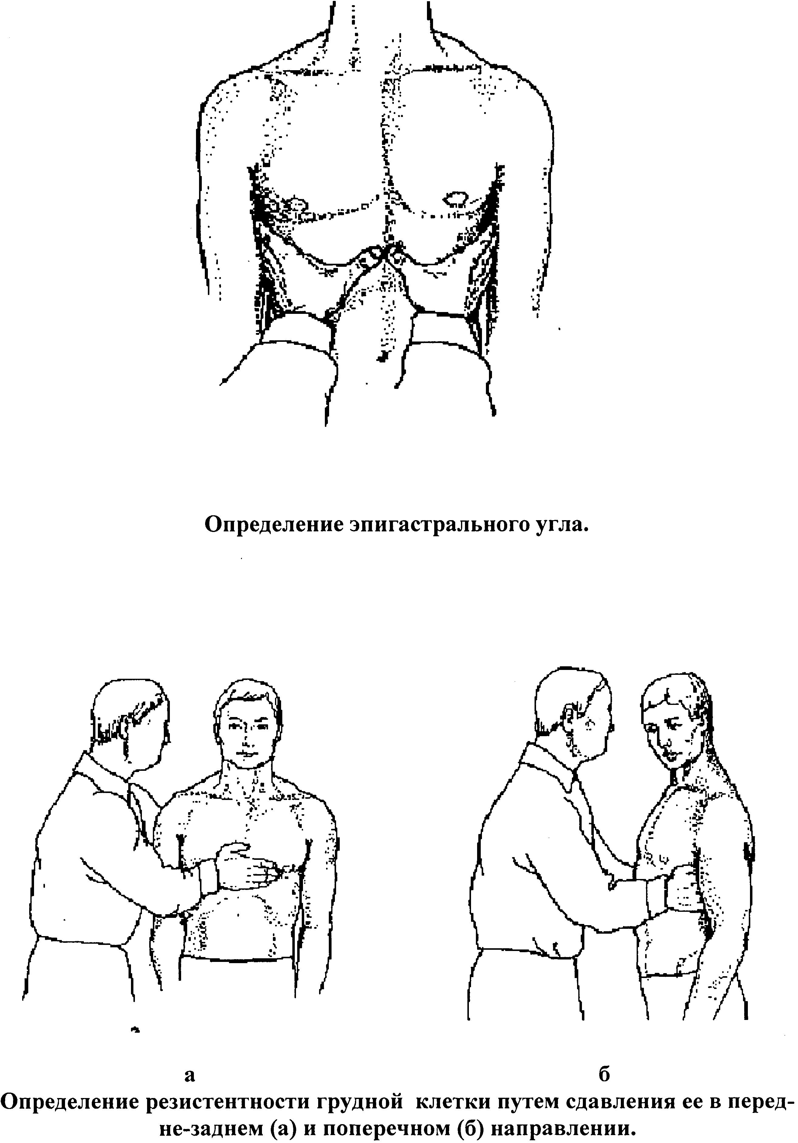 Резистентность грудной. Тип грудной клетки надчревный угол. Как измерить надчревный угол. Пальпация грудной клетки эпигастральный угол. Межреберный угол Тип телосложения.