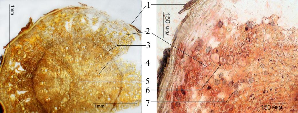 Щавель персик ракушка половые губы форма фото. Микроскопия щавеля конского. Корни щавеля конского микроскопия. Конский щавель корень. Корень Алтея микроскопия.