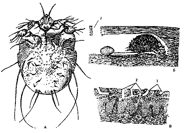Цикл развития чесоточного клеща. Чесоточный зудень самка. Внутреннее строение чесоточного зудня. Sarcoptes scabiei строение.