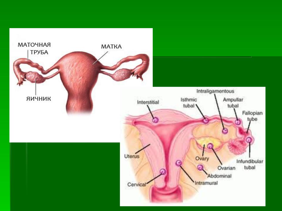 Женская половая труба. Маточные трубы. Матка и маточные трубы анатомия. Строение маточной трубы.