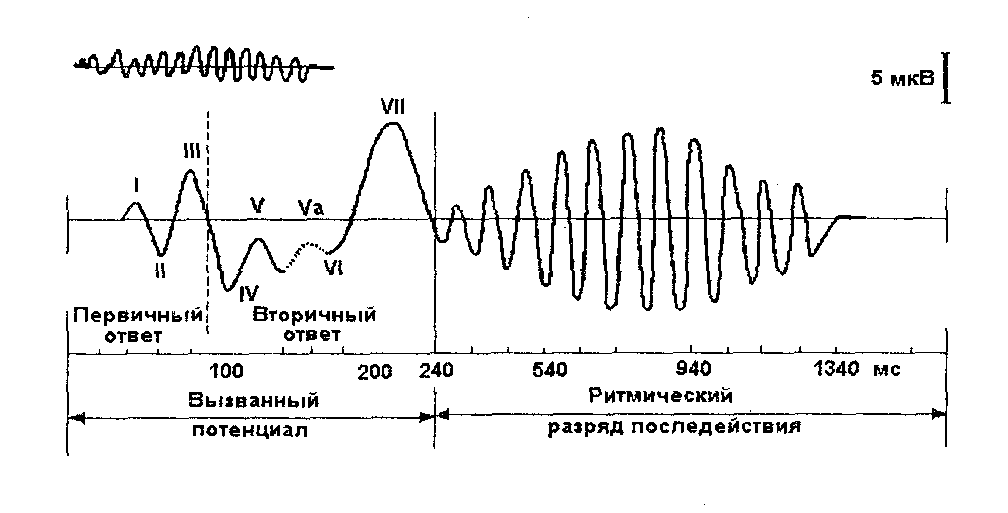 Вызванный исследования. Вызванные потенциалы и потенциалы, связанные с событиями.. Событийно-связанные вызванные потенциалы это. Метод вызванных потенциалов ЭЭГ. Вызванные потенциалы процедура.