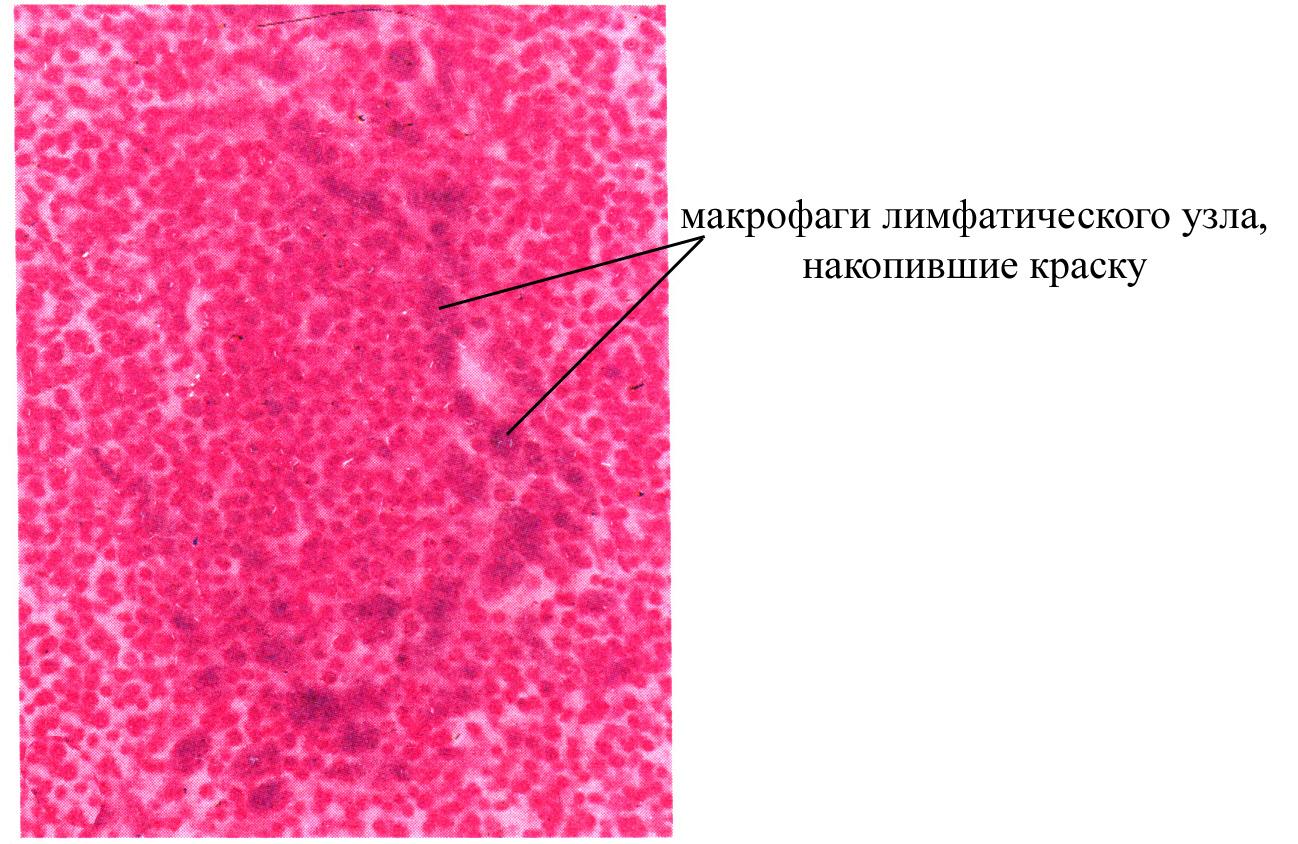 Реактивная гиперплазия лимфоузла. Накопление краски в лимфатическом узле препарат. Макрофаги лимфатических узлов. Ретикулярная ткань гистология препарат. Ретикулярная ткань лимфоузел гистология.