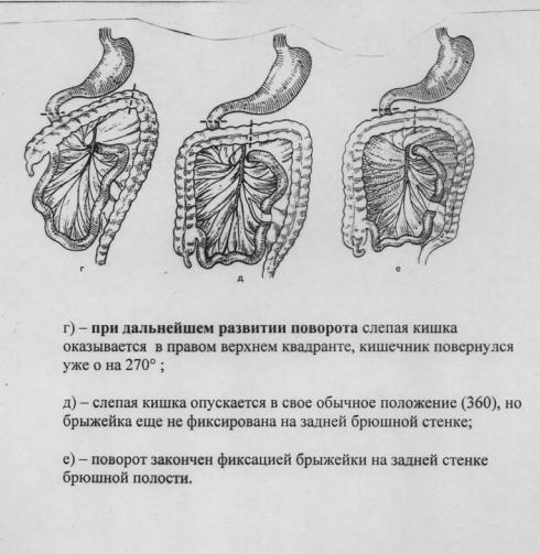 Пилорический отдел желудка развит что при относительной