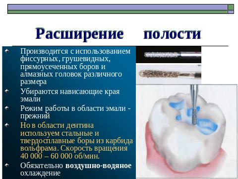 Фиссурный бор в стоматологии фото