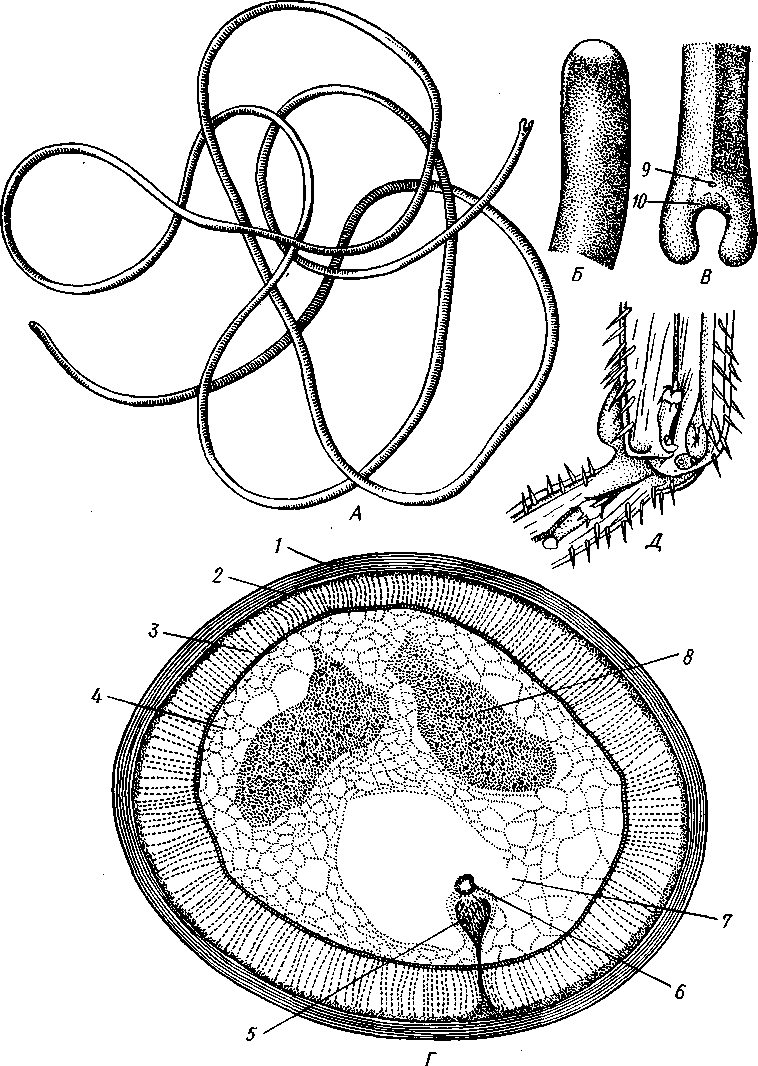 Передний и задний конец червя. Волосатик Gordius aquaticus. Волосатики черви строение. Круглые черви класс волосатики.