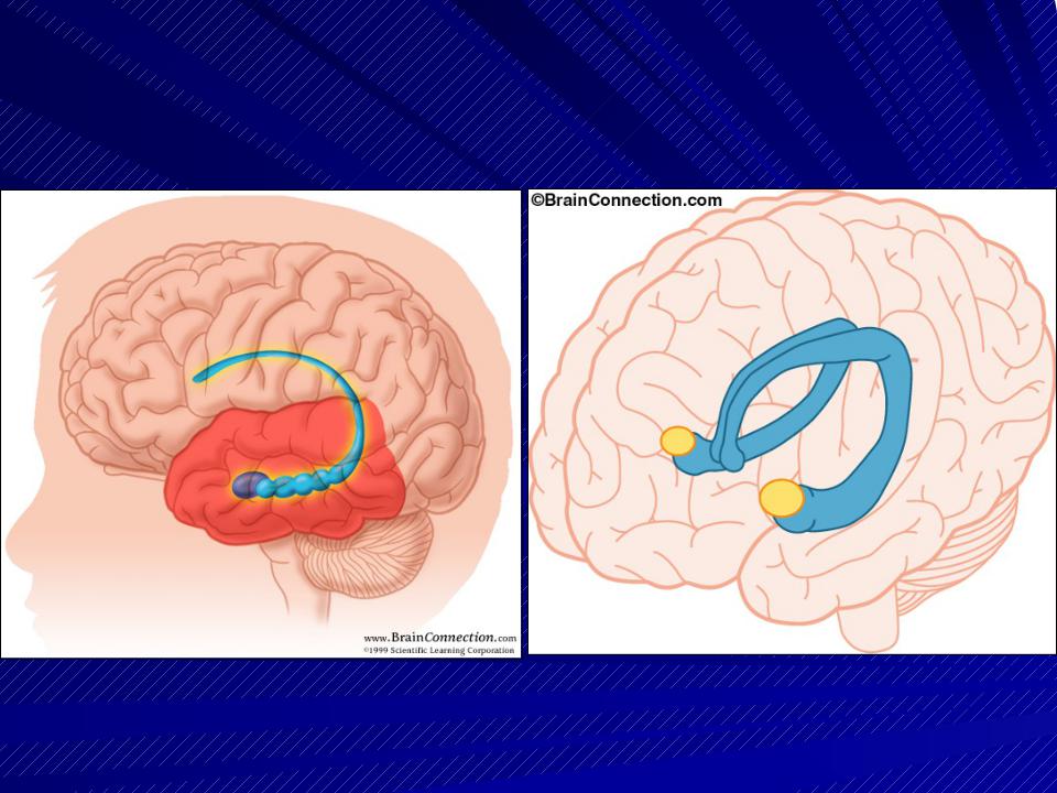 Свод головного мозга. Столбы свода головного мозга. Свод мозга анатомия. Свод и его части головной мозг. Свод и гиппокамп.