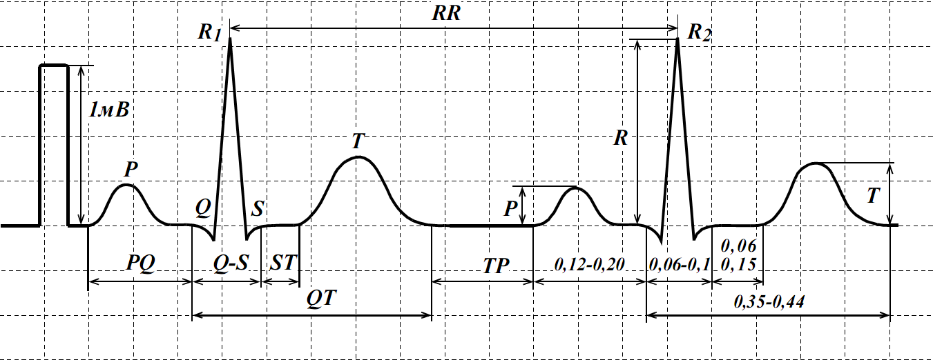Схема нормальной экг