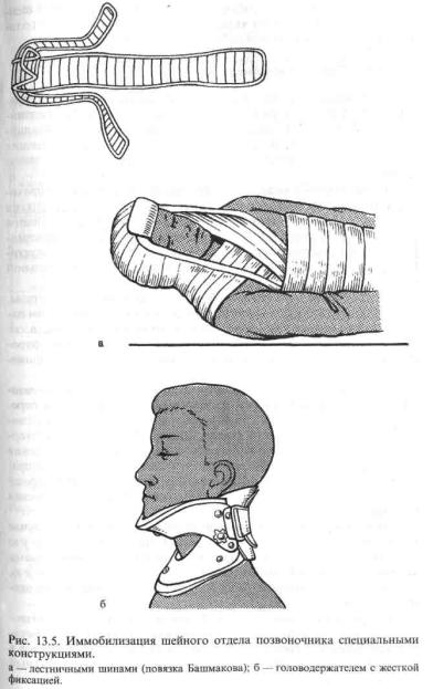 Иммобилизация при повреждении шейного отдела
