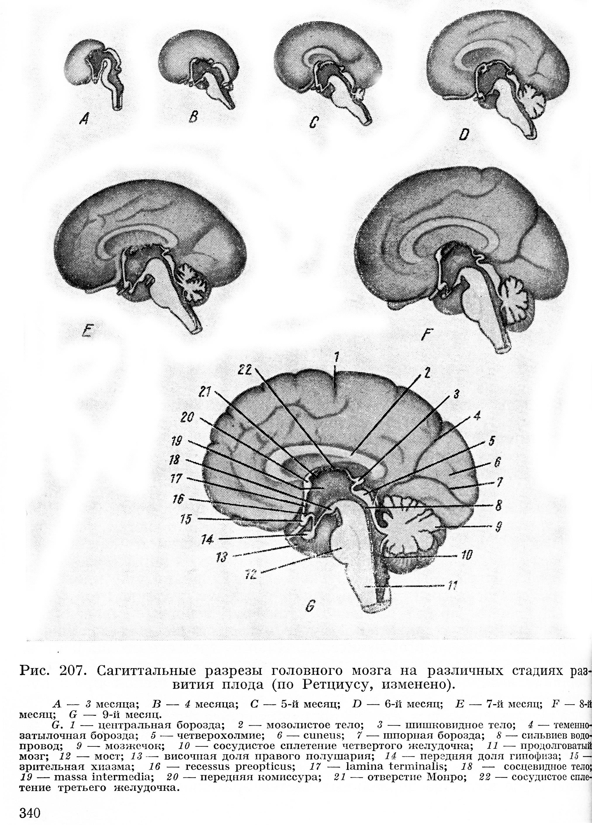 Эмбриогенез мозга человека. Шишковидная железа мозг в разрезе. Сагиттальный разрез головного мозга анатомия. Схему развития головного мозга человека. Изобразите схему развития головного мозга человека.