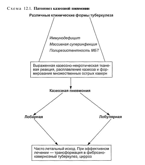 Клиническая картина казеозной пневмонии обычно характеризуется