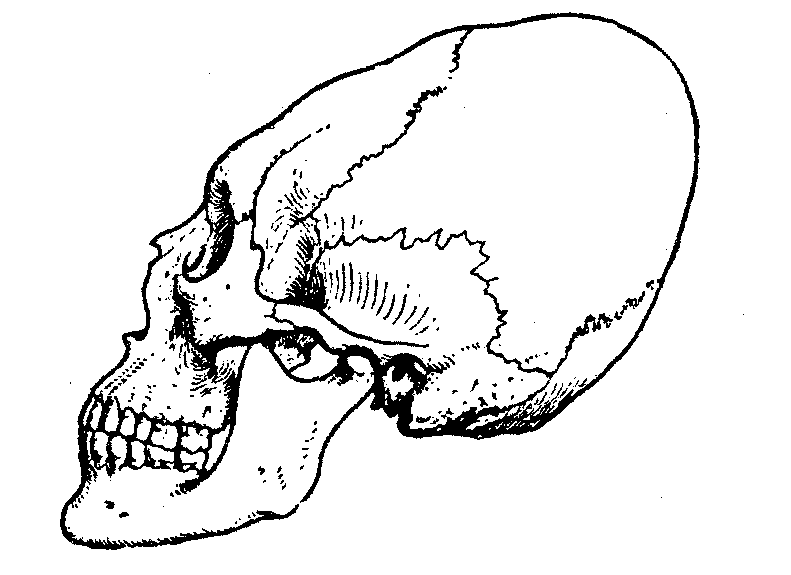 Черепная аномалия. Искусственная деформация черепа. Деформация черепа у животных. Нижняя челюсть немного искривлена череп рисунок. Боксер с деформации черепа.