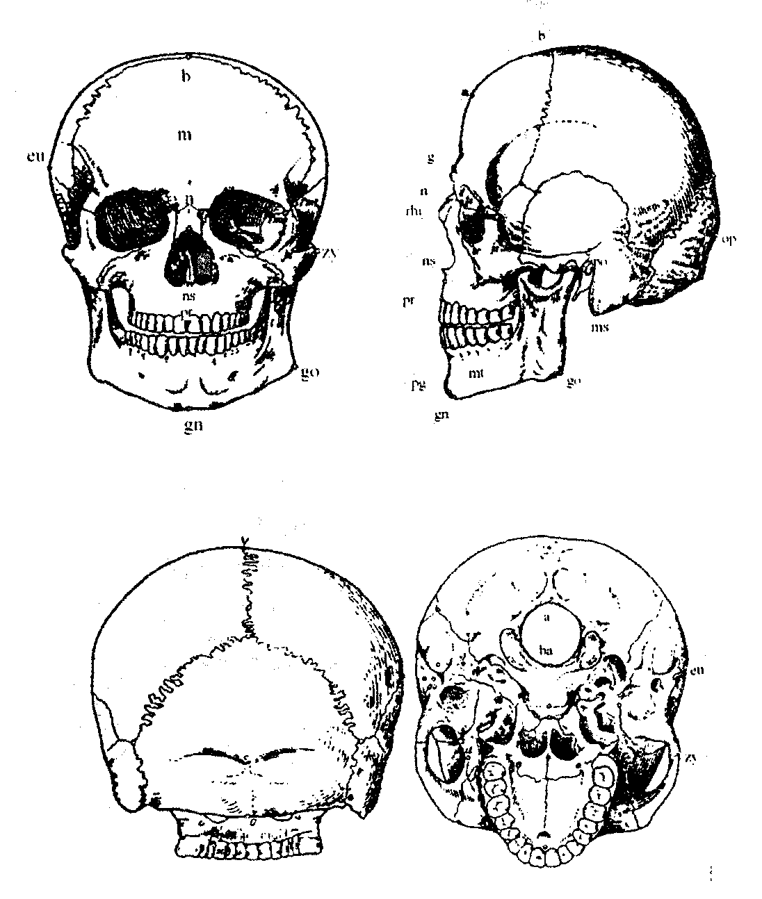Проникающая в полость черепа. Краниометрические точки на черепе. Точки Эурион. Антропометрические точки черепа человека. Точка гонион на черепе.
