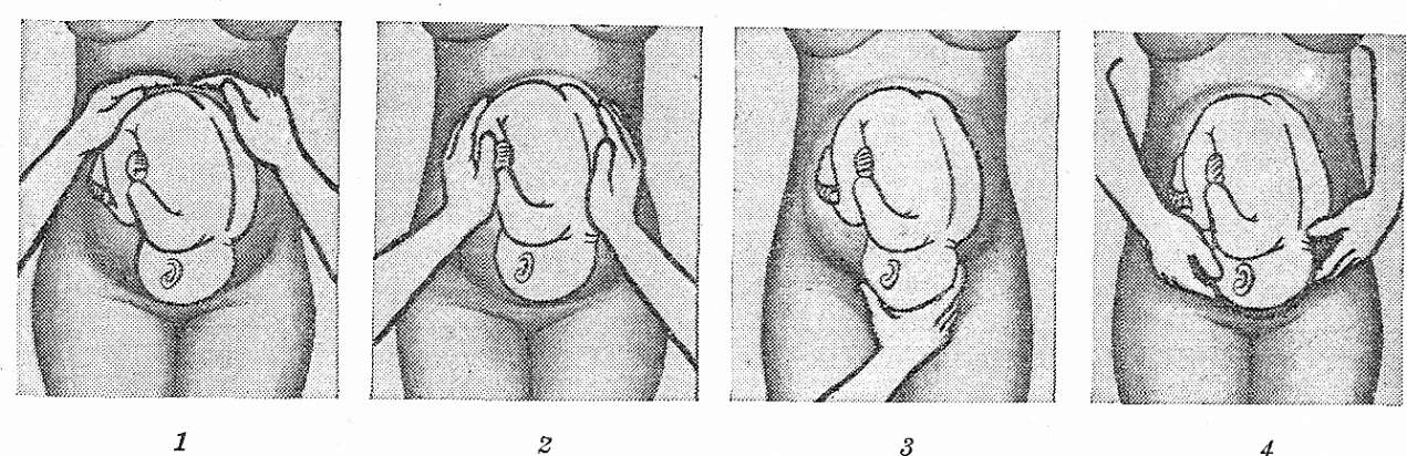 Ведение нормальных родов - Гинекология и акушерство - Справочник MSD Профессиональная версия