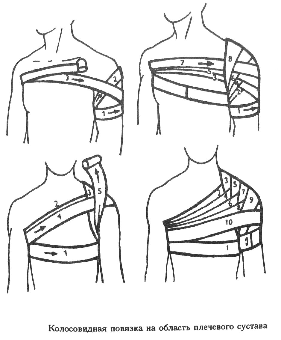 Повязка при ранении плеча