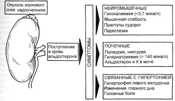 Синдром кона презентация