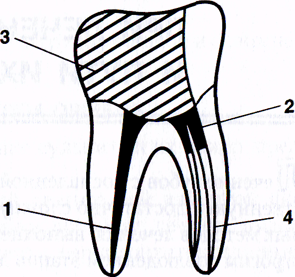 Комбинированный метод лечения зубов thumbnail