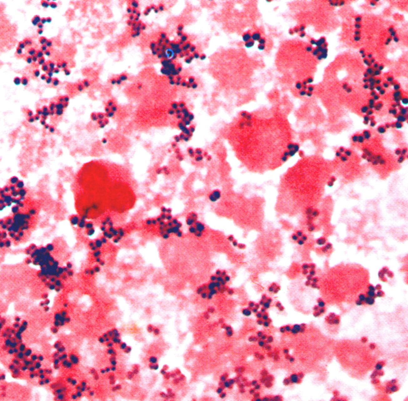 1 staphylococcus aureus. Бактериоскопический метод стафилококков. Стафилококк золотистый микроскопирование. Бактериоскопия стафилококк. Менингитный стафилококк.