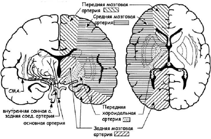 Синдром окклюзии передней мозговой артерии