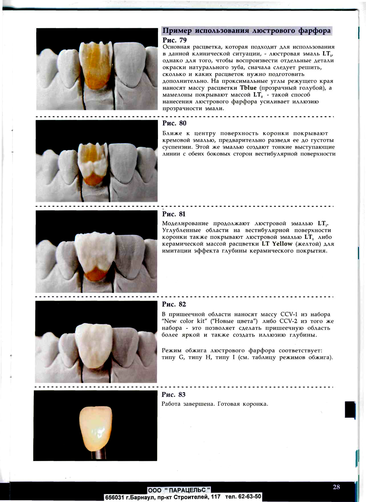 Зуботехническая керамика Noritake EX-3 опак дентин