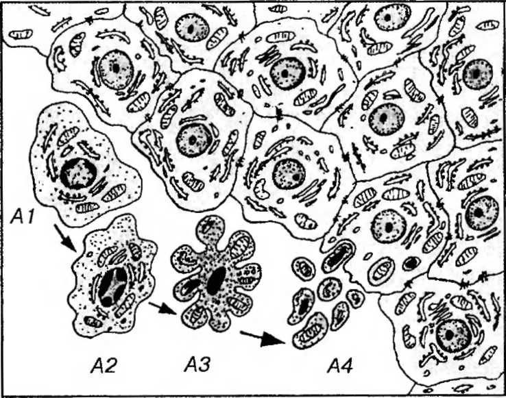 Апоптоз кариорексис. Кариолизис рисунок. Кариопикноз уплотнение хроматина. Клетка при апоптозе микроскоп.