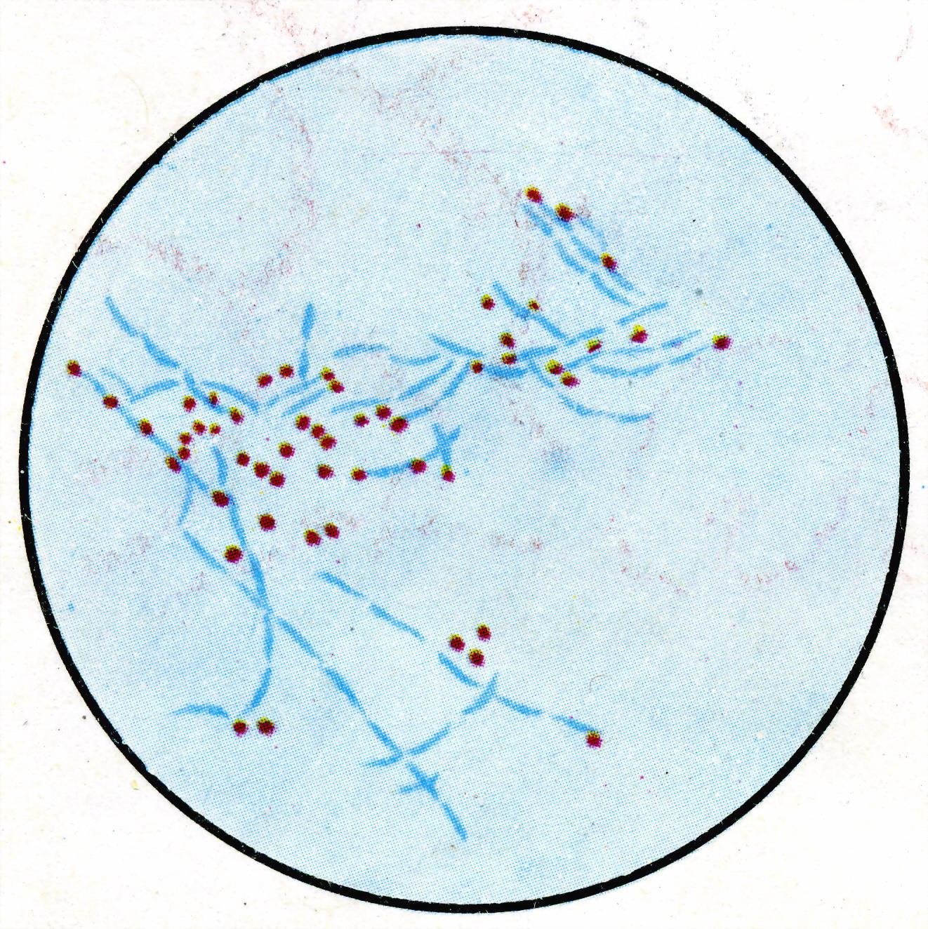 Окраска спор бактерий. Споры окраска по Ожешко. Bacillus subtilis окраска по Ожешко. Bacillus anthracis окраска по Ожешко. Сибирская язва окраска по Ожешко.