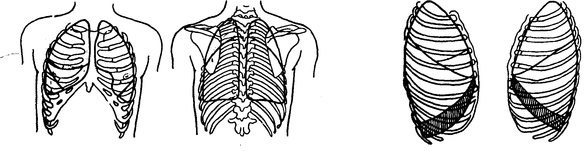 Площадь поверхности грудной клетки у человека. Схема грудной клетки в прямой проекции. Легочные борозды на грудной клетке. Проекции междолевых границ легких. Проекция легких и плевры на грудную клетку.