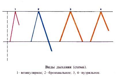 Дыхание пуэрильное: что это значит у ребенка? - ufokids
