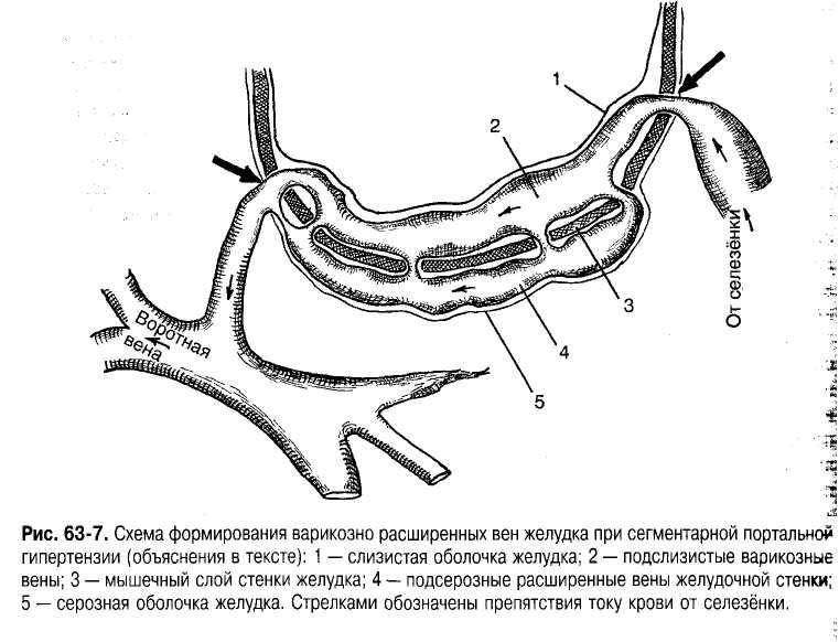 Вены желудка. Венозный отток желудка. Подслизистые вены желудка.