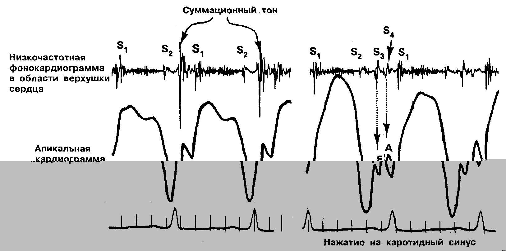 Суммационное изображение это
