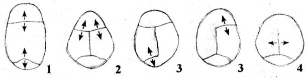 Варианты формы черепа. Долихоцефалия черепа у новорожденного. Формы головы у новорожденных долихоцефалия. Краниостеноз яйцевидная форма головы. Краниостеноз башенный череп.